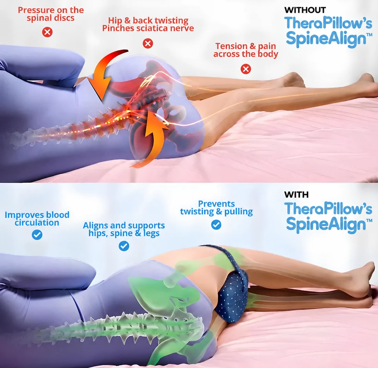 Without support the upper leg drops forward and the hip and lower back rotate; with support between the knees the legs, hips and spine rest in a straighter line